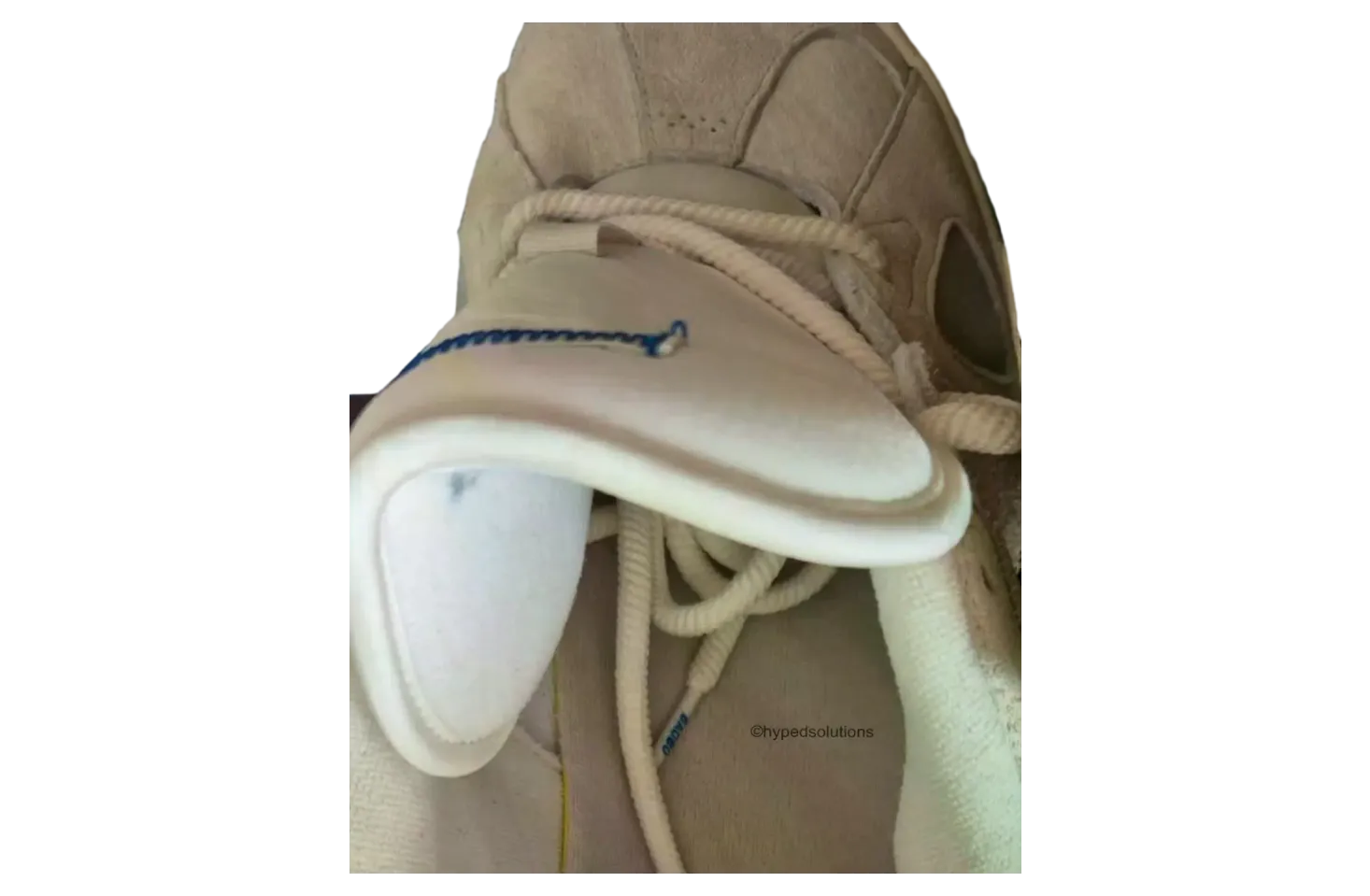 bad bunny x adidas badbo 1 0 resilience 3